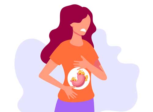 Heartburn and GERD: A Holistic Approach