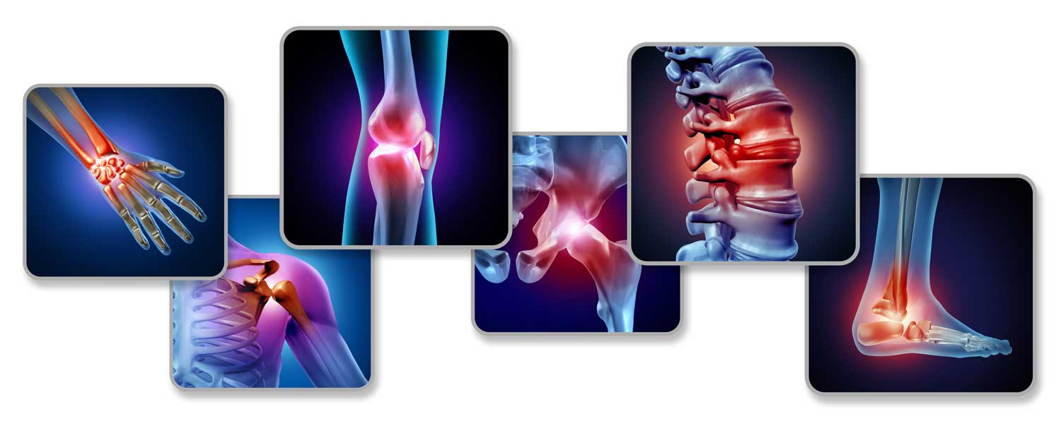 Natural Ways to Improve Joint Health & Ease Pain